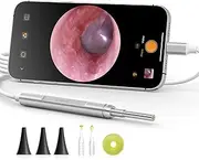 Anykit USB-C Digital Otoscope for Type-C Phone & Tablet, Ultra Clear View Ear Camera with Ear Wax Removal Tools, Video Ear Scope Otoscope with Light, Support Capture Photo & Record Videos(Silver)