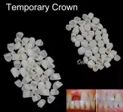 60pcs Dental Temporary Crown denture Veneers Material Anterior Molar Resin Teeth