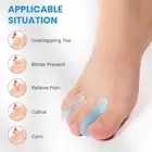 Gel Toe Separators for Bunion Relief– Toe Straightener for Corn, Blister Prevent
