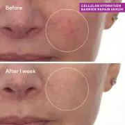 Murad Cellular Hydration Repair Serum 30ml