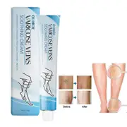 Vein Repair Cream - Improve Blood Circulation and Reduce Varicose Veins 1pcs