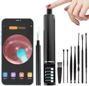 Ear Wax Removal Tool Camera, Ear Cleaner Camera Earwax Removal kit with Camera,