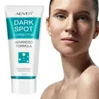 Dark Spot Remover Skin Corrector Freckle Removal Mole Face Tone Whitening Cream