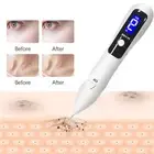 Freckle Pen Professional Safe Mole Removal Point Pen Portable