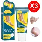 FootEase by Watsons Cracked Heel Cream Heal & Moisturize for Healthy Feet 3X50G