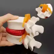 Human Anatomy Skeleton Spine Lumbar Disc Herniation Model Brain Skull Traumatic