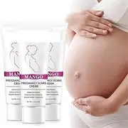 Stretch Mark Cream Remove Pregnancy Scars Skin Body Cream Postpartum Stretch Marks Repair Cream Anti-Aging Skin Winkles Firming Body Cream