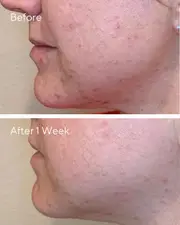 Murad Daily Clarifying Peel 95ml