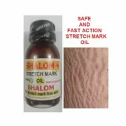 SHALOM STRETCH MARK TREATMENT OIL X 2