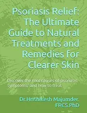 Psoriasis Relief: The Ultimate Guide to Natural Treatments and Remedies for Clearer Skin: Discover the root causes of psoriasis, symptoms, and how to treat