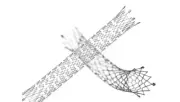 Bard ZBL06080 E-LUMINEXX Biliary Stent - 6mm x 80mm x 135cm