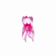 EndoTooth 84 Deciduous Lower Molar - Dental Root Canal Model for Practice