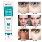 Whitening Freckle Cream Remove Dark Spots Anti-Freckle Cream Niacinamide Fade-AU