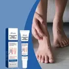 Wolfsbane Athlete's Foot Ointment Anti Fungal Healing Effective Treatme /б U3D5
