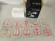 THINKGEEK Anatomic Brain Specimen Coasters Set of 10 pieces Original Open Box