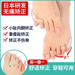 日本 小腳趾內翻矯正器 分趾器 小拇指外翻矯正器 腳趾保護套 可穿鞋