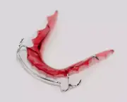 Hawley Lower Retainer, Custom Made, Wire Teeth Retainers Online, At-Home
