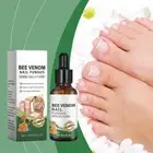 Nail Treatment Fungus Anti Fungal Toe Removal Care Liquid Solution Best