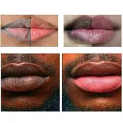 1-3x Lip Lightening Scrub Balm Lightens Lips Hyaluronic 20g 2pcs