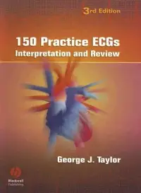 在飛比找博客來優惠-150 Practice ECGs: Interpretat