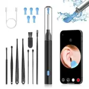 Wireless Ear Wax Removal Kit – Safe, Smart Cleaning with HD Camera Tip