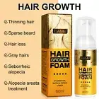 5% Minoxidil Hair Regrowth Foam Treatment for Men Hair Growing Anti Hair Loss