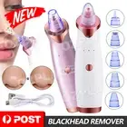 Face Facial Pore Blackhead Remover Vacuum Derma Suction Diamond Dermabrasion