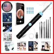 Ear Wax Removal Kit with 1296P HD Camera for Safe and Effective Cleaning
