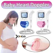 Backlight Prenatal Monitor LCD Heart Beat Baby with Probe Fetal Doppler 2MHz