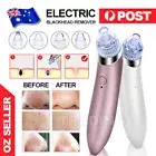 Face Facial Pore Blackhead Remover Vacuum Derma Suction Diamond Dermabrasion