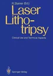 Laser Lithotripsy: Clinical Use and Technical Aspects by Rudolf W. Steiner (Engl