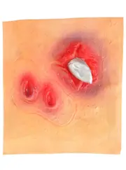 Vampire Bite Self Adhesive Wound