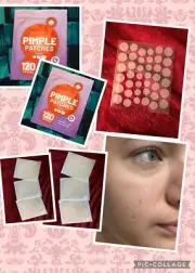 KEYCONCEPTS Pimple Patches 2 pk Hydrocolloid Acne Patches Tea Tree Oil 240 Total