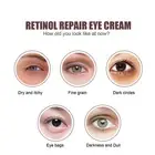 2pcs Retinoids Eye Cream 0.7 Oz Reduce Fine Line Anti Aging Repairing Wrinkl GS0