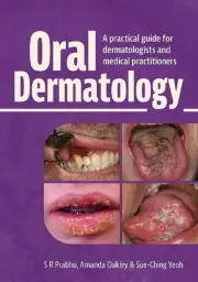 S.R. Prabhu Amanda Oakley Sue-Ching Yeoh Oral Dermatology (Hardback)