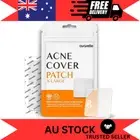 Pimple Patches XL, Acne Treatment with Tea Tree, Calendula, Cica, Large Size