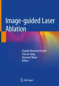 在飛比找博客來優惠-Image-Guided Laser Ablation