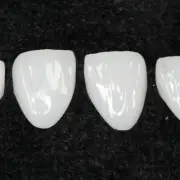 3Pc No.23# Teeth Veneer Dental Veneers Tooth Whitening Ceramic Crystal White LMS