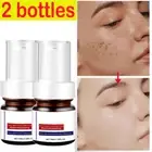 2X Anti Spot Serum, Freckle Removing Essence, Vitamin C Freckle Cream 40ml