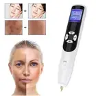Pro Plasma Mole Pen Laser Freckle Tag Acne Dark Spot Remover Beauty Skin lifting