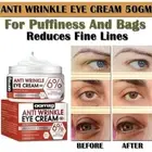 Eye Cream Anti Aging: Under Eye Cream for Dark Circles Puffiness Eye Bags - 50 g