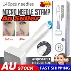 Adjust 0-3.0mm DRS140 Derma Needle Stamp Microneedle Care Roller Anti-Ageing QS