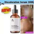 Dark Spot Correcting Serum for Face: Dark Spot Remover for Age Spot Sun Spot USA