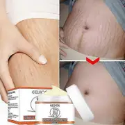 Elrachen 2x Stretch Marks Removal Cream Fat Growth Streaks Maternity Scars Acne Repair Increase Skin Elasticity Anti-wrinkle Firm Body Care