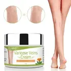 VASCULITIS TREATMENT CREAM PHLEBITIS SPIDER VEINS VARICOSE VEINS STRETCH MARKS