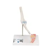 A87/1 Mini Elbow Joint w/cross sec of bone on base - 3B Smart Anatomy