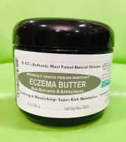 Intense Treatment Butter/Cream Eczema Psoriasis Rosacea Dermatitis Shingles Rash