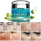 Dark Spot Remover for Face, Hyperpigmentation Treatment, Melasma, Freckle, Sun