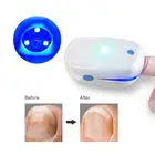 Red Light Therapy for Fungus Finger Toe Nails Anti Fungal Treatment Laser Device