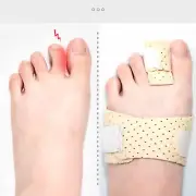 Hammer Toe Straightener Adjustable Toe Corrector For Recovery